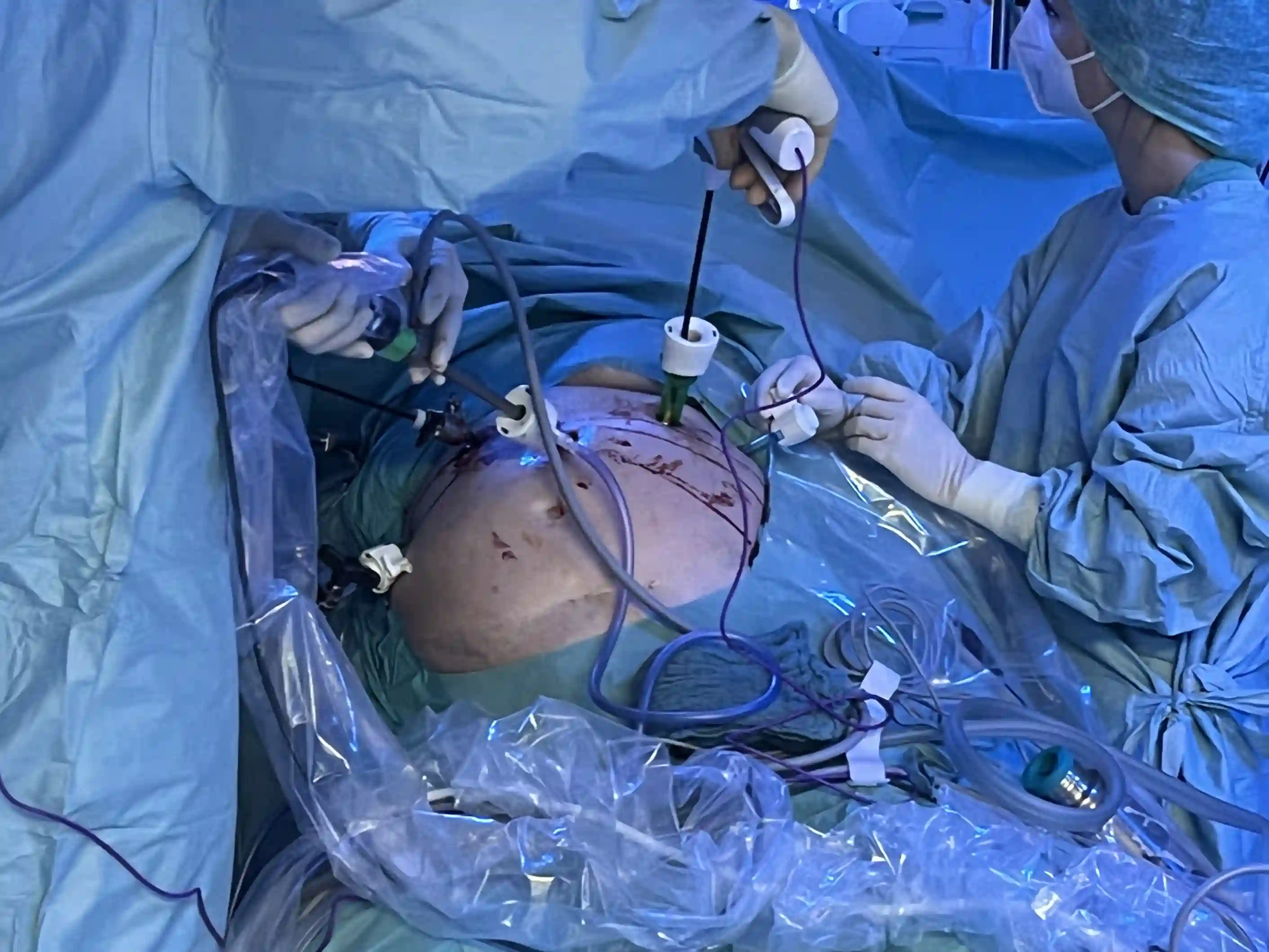 Inside the operating room &mdash; Advitya Healthcares