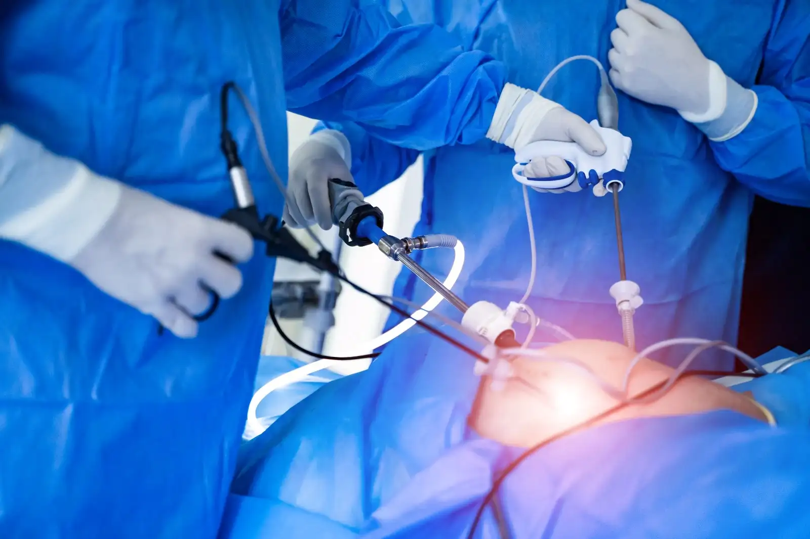 Laparoscopic and open surgery