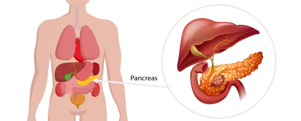 Illustration of the pancreas in the body, with a magnified view of the gland beside the liver and duodenum
