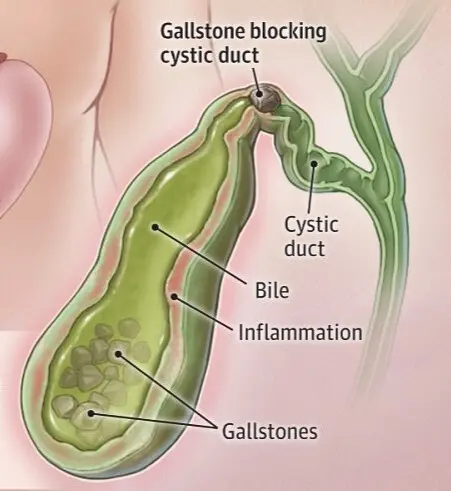 7e269190 94df 4471 8c15 0e0b9cb91461