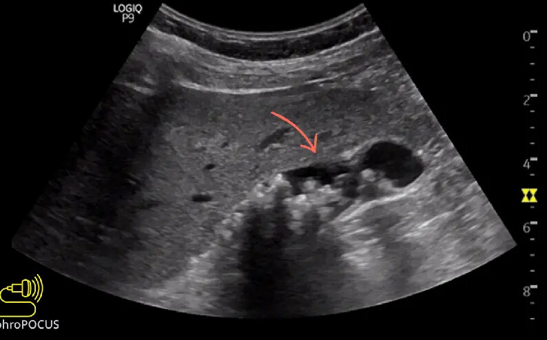 9c0bb605 d070 434b 941f 90f4e87a7c6d