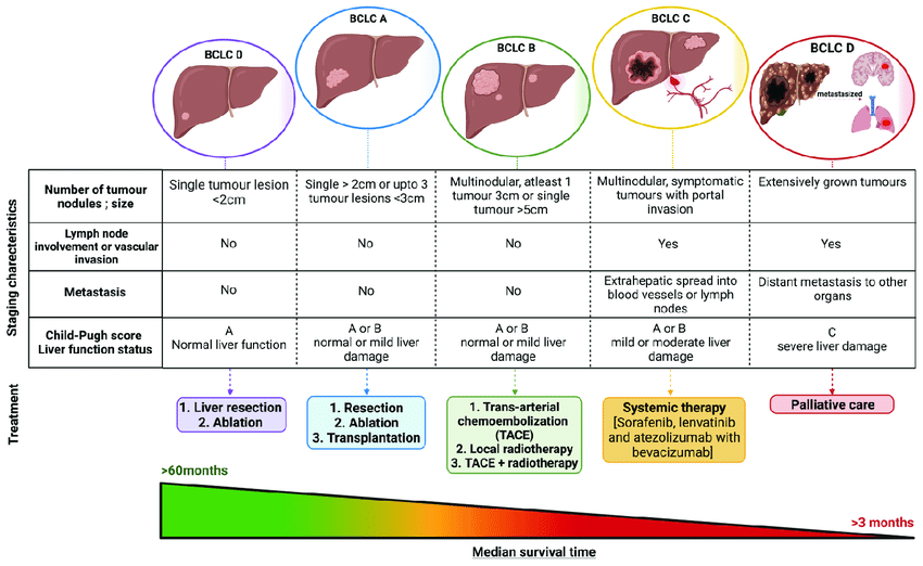 Classification of hcc and its characteristics based on the bclc staging system hcc can Pancreacare logo with white background