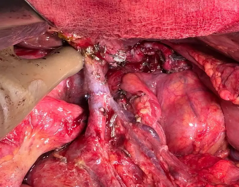 Whatsapp image 2025 10 05 at 6.26.25 pm