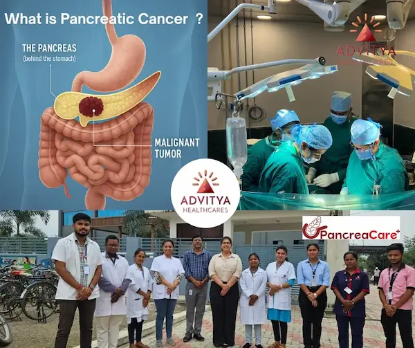 Pancreatic Cancer Awareness Month: Empowering Ranchi with The Expertise of Advitya Healthcares