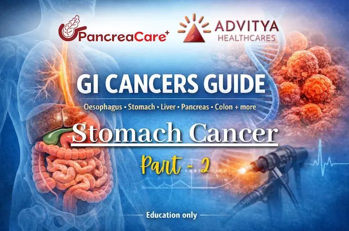 Your guide to Stomach Cancer, Everything You Need to Know