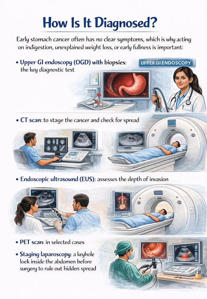 how is tomach cancer diagnosed